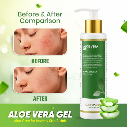 Aloe Vera Gel